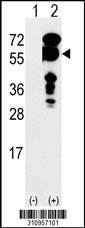 Western blot analysis of his-tag MECP2 (arrow) using his tag antibody. 293 cell lysates (2 ug/lane) either nontransfected (Lane 1) or transiently transfected with the MECP2 gene