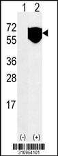 Western blot analysis of his-tag HSPA1A (arrow) using his tag antibody. 293 cell lysates (2 ug/lane) either nontransfected (Lane 1) or transiently transfected with the HSPA1A gene