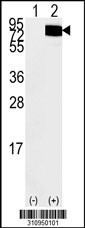 Western blot analysis of his-tag DYNC1I1 (arrow) using his tag antibody. 293 cell lysates (2 ug/lane) either nontransfected (Lane 1) or transiently transfected with the DYNC1I1 gene