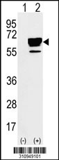 Western blot analysis of his-tag CTNNA1 (arrow) using his tag antibody. 293 cell lysates (2 ug/lane) either nontransfected (Lane 1) or transiently transfected with the CTNNA1 gene