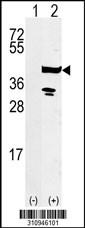 Western blot analysis of his-tag CNP (arrow) using his tag antibody. 293 cell lysates (2 ug/lane) either nontransfected (Lane 1) or transiently transfected with the CNP gene