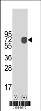 Western blot analysis of his-tag CD200R1 (arrow) using his tag antibody. 293T cell lysates (2 ug/lane) either nontransfected (Lane 1) or transiently transfected with the CD200R1 gene‘