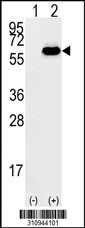 Western blot analysis of his-tag CETP (arrow) using his tag antibody. 293 cell lysates (2 ug/lane) either nontransfected (Lane 1) or transiently transfected with the CETP gene