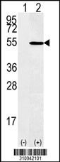 Western blot analysis of his-tag CDC20 (arrow) using his tag antibody. 293 cell lysates (2 ug/lane) either nontransfected (Lane 1) or transiently transfected with the CDC20 gene