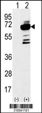Western blot analysis of his-tag CBS (arrow) using his tag antibody. 293 cell lysates (2 ug/lane) either nontransfected (Lane 1) or transiently transfected with the CBS gene