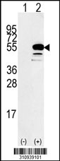 Western blot analysis of his-tag B4GALT3 (arrow) using his tag antibody. 293 cell lysates (2 ug/lane) either nontransfected (Lane 1) or transiently transfected with the B4GALT3 gene