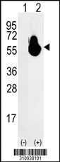 Western blot analysis of his-tag ASS1 (arrow) using his tag antibody. 293 cell lysates (2 ug/lane) either nontransfected (Lane 1) or transiently transfected with the ASS1 gene