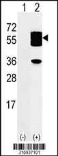 Western blot analysis of his-tag ALDH3B1 (arrow) using his tag antibody. 293 cell lysates (2 ug/lane) either nontransfected (Lane 1) or transiently transfected with the ALDH3B1 gene