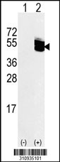 Western blot analysis of his-tag TUFM (arrow) using his tag antibody. 293 cell lysates (2 ug/lane) either nontransfected (Lane 1) or transiently transfected with the TUFM gene