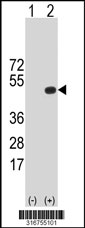 Western blot analysis of his-tag KIR2DS2 (arrow) using his tag antibody. 293T cell lysates (2 ug/lane) either nontransfected (Lane 1) or transiently transfected with the KIR2DS2 gene‘