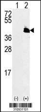 Western blot analysis of his-tag SERPINA3 (arrow) using his tag antibody. 293 cell lysates (2 ug/lane) either nontransfected (Lane 1) or transiently transfected with the SERPINA3 gene