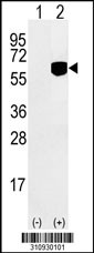 Western blot analysis of his-tag RUVBL2 (arrow) using his tag antibody. 293 cell lysates (2 ug/lane) either nontransfected (Lane 1) or transiently transfected with the RUVBL2 gene