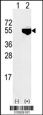 Western blot analysis of his-tag MLLT6 (arrow) using his tag antibody. 293 cell lysates (2 ug/lane) either nontransfected (Lane 1) or transiently transfected with the MLLT6 gene