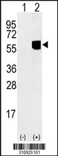Western blot analysis of his-tag MINA (arrow) using his tag antibody. 293 cell lysates (2 ug/lane) either nontransfected (Lane 1) or transiently transfected with the MINA gene