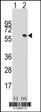 Western blot analysis of his-tag KIR2DL1 (arrow) using his tag antibody. 293T cell lysates (2 ug/lane) either nontransfected (Lane 1) or transiently transfected with the KIR2DL1 gene‘