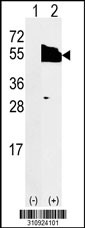 Western blot analysis of his-tag KRT18 (arrow) using his tag antibody. 293 cell lysates (2 ug/lane) either nontransfected (Lane 1) or transiently transfected with the KRT18 gene