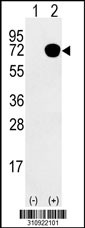 Western blot analysis of his-tag HNRNPK (arrow) using his tag antibody. 293 cell lysates (2 ug/lane) either nontransfected (Lane 1) or transiently transfected with the HNRNPK gene