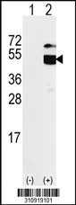 Western blot analysis of his-tag GCDH (arrow) using his tag antibody. 293 cell lysates (2 ug/lane) either nontransfected (Lane 1) or transiently transfected with the GCDH gene