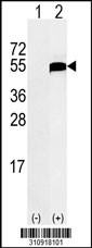 Western blot analysis of his-tag FGG (arrow) using his tag antibody. 293 cell lysates (2 ug/lane) either nontransfected (Lane 1) or transiently transfected with the FGG gene