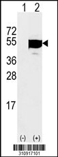 Western blot analysis of his-tag ENO1 (arrow) using his tag antibody. 293 cell lysates (2 ug/lane) either nontransfected (Lane 1) or transiently transfected with the ENO1 gene