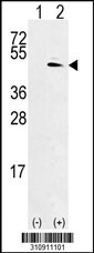 Western blot analysis of his-tag CPB2 (arrow) using his tag antibody. 293 cell lysates (2 ug/lane) either nontransfected (Lane 1) or transiently transfected with the CPB2 gene