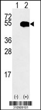 Western blot analysis of his-tag CALR (arrow) using his tag antibody. 293 cell lysates (2 ug/lane) either nontransfected (Lane 1) or transiently transfected with the CALR gene