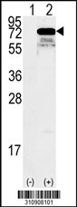 Western blot analysis of his-tag BLNK (arrow) using his tag antibody. 293 cell lysates (2 ug/lane) either nontransfected (Lane 1) or transiently transfected with the BLNK gene