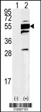 Western blot analysis of his-tag ASL (arrow) using his tag antibody. 293 cell lysates (2 ug/lane) either nontransfected (Lane 1) or transiently transfected with the ASL gene