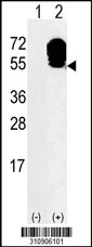 Western blot analysis of his-tag AMOTL2 (arrow) using his tag antibody. 293 cell lysates (2 ug/lane) either nontransfected (Lane 1) or transiently transfected with the AMOTL2 gene