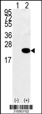 Western blot analysis of his-tag SNCA (arrow) using his tag antibody. 293 cell lysates (2 ug/lane) either nontransfected (Lane 1) or transiently transfected with the SNCA gene
