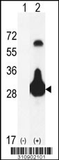 Western blot analysis of his-tag RNF114 (arrow) using his tag antibody. 293 cell lysates (2 ug/lane) either nontransfected (Lane 1) or transiently transfected with the RNF114 gene