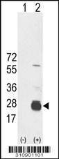 Western blot analysis of his-tag RNF11 (arrow) using his tag antibody. 293 cell lysates (2 ug/lane) either nontransfected (Lane 1) or transiently transfected with the RNF11 gene