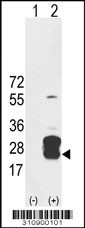 Western blot analysis of his-tag PTGDS (arrow) using his tag antibody. 293 cell lysates (2 ug/lane) either nontransfected (Lane 1) or transiently transfected with the PTGDS gene