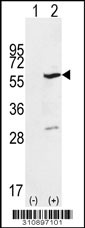 Western blot analysis of his-tag PPOX (arrow) using his tag antibody. 293 cell lysates (2 ug/lane) either nontransfected (Lane 1) or transiently transfected with the PPOX gene
