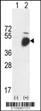 Western blot analysis of his-tag LZP(S)(OIT3) (arrow) using his tag antibody. 293 cell lysates (2 ug/lane) either nontransfected (Lane 1) or transiently transfected with the LZP(S)(OIT3) gene