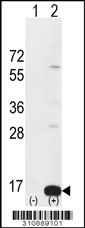 Western blot analysis of his-tag LSM2 (arrow) using his tag antibody. 293 cell lysates (2 ug/lane) either nontransfected (Lane 1) or transiently transfected with the LSM2 gene