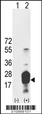 Western blot analysis of his-tag LDLRAD1 (arrow) using his tag antibody. 293 cell lysates (2 ug/lane) either nontransfected (Lane 1) or transiently transfected with the LDLRAD1 gene