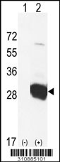 Western blot analysis of his-tag GSTO2 (arrow) using his tag antibody. 293 cell lysates (2 ug/lane) either nontransfected (Lane 1) or transiently transfected with the GSTO2 gene