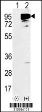 Western blot analysis of his-tag GMEB1 (arrow) using his tag antibody. 293 cell lysates (2 ug/lane) either nontransfected (Lane 1) or transiently transfected with the GMEB1 gene