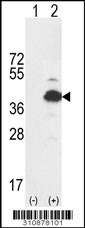 Western blot analysis of his-tag FARS2 (arrow) using his tag antibody. 293 cell lysates (2 ug/lane) either nontransfected (Lane 1) or transiently transfected with the FARS2 gene