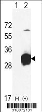Western blot analysis of his-tag CA7 (arrow) using his tag antibody. 293 cell lysates (2 ug/lane) either nontransfected (Lane 1) or transiently transfected with the CA7 gene