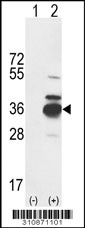 Western blot analysis of his-tag BCKDHB (arrow) using his tag antibody. 293 cell lysates (2 ug/lane) either nontransfected (Lane 1) or transiently transfected with the BCKDHB gene