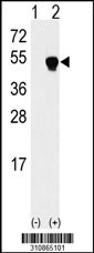 Western blot analysis of his-tag SERPINB3 (arrow) using his tag antibody. 293 cell lysates (2 ug/lane) either nontransfected (Lane 1) or transiently transfected with the SERPINB3 gene