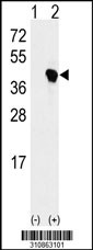 Western blot analysis of his-tag RMND5B (arrow) using his tag antibody. 293 cell lysates (2 ug/lane) either nontransfected (Lane 1) or transiently transfected with the RMND5B gene