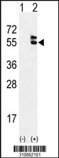 Western blot analysis of his-tag RGP1 (arrow) using his tag antibody. 293 cell lysates (2 ug/lane) either nontransfected (Lane 1) or transiently transfected with the RGP1 gene