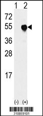 Western blot analysis of his-tag PSMC4 (arrow) using his tag antibody. 293 cell lysates (2 ug/lane) either nontransfected (Lane 1) or transiently transfected with the PSMC4 gene