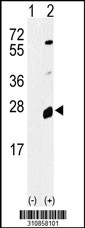 Western blot analysis of his-tag PLUNC (arrow) using his tag antibody. 293 cell lysates (2 ug/lane) either nontransfected (Lane 1) or transiently transfected with the PLUNC gene