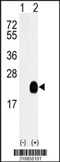 Western blot analysis of his-tag HRASLS3(PLA2G16) (arrow) using his tag antibody. 293 cell lysates (2 ug/lane) either nontransfected (Lane 1) or transiently transfected with the HRASLS3(PLA2G16) gene