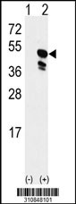 Western blot analysis of his-tag GNAS (arrow) using his tag antibody. 293 cell lysates (2 ug/lane) either nontransfected (Lane 1) or transiently transfected with the GNAS gene