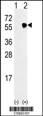 Western blot analysis of his-tag FIP1L1 (arrow) using his tag antibody. 293 cell lysates (2 ug/lane) either nontransfected (Lane 1) or transiently transfected with the FIP1L1 gene
